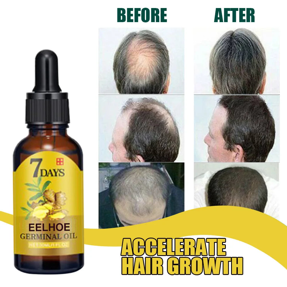 Hair Growth Serum 