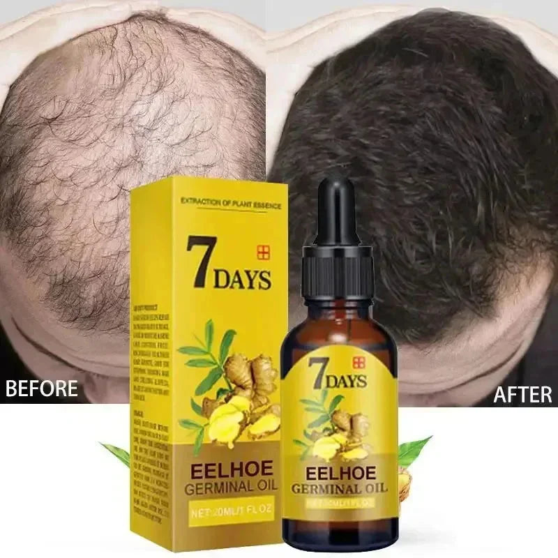 Hair Growth Serum 